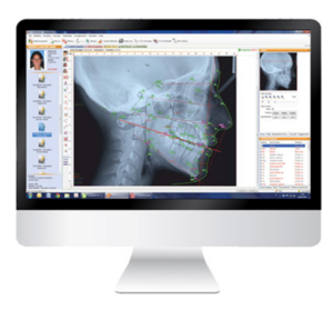 ANALISI FOTOGRAFICA E DIAGNOSI CEFALOMETRICA