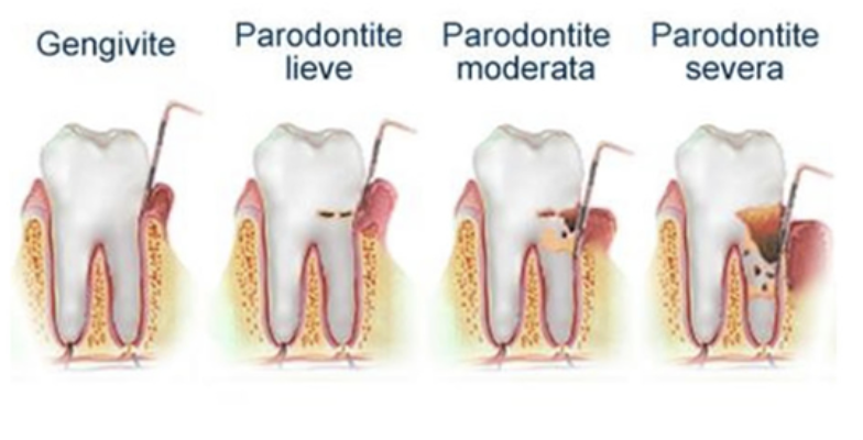 risorsa 3 - parondotologia