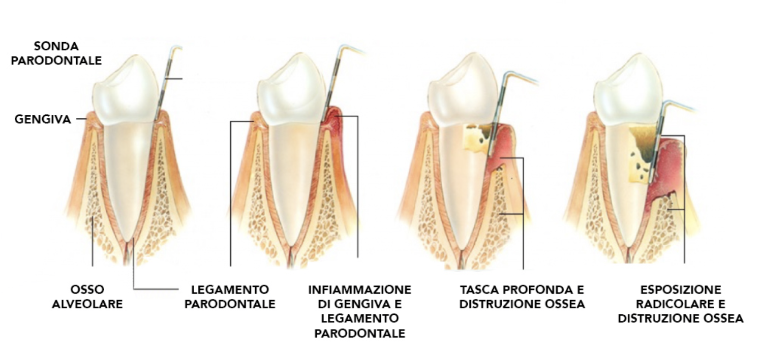 parondotologia mod